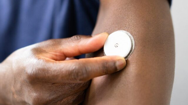 A continuous glucose monitor